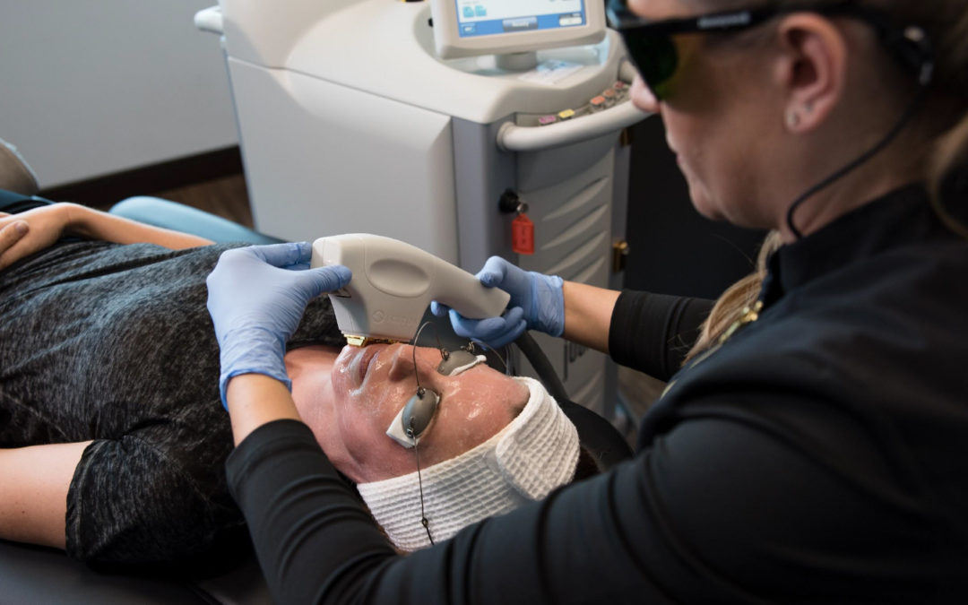 Laser Halo Treatment: How It Works, Skin Benefits, and What to Expect After